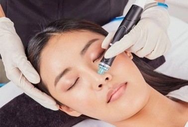 Hidrofacial