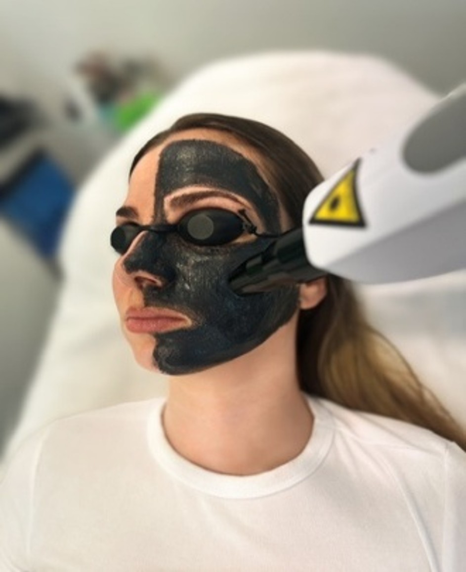 Carbon-Laser